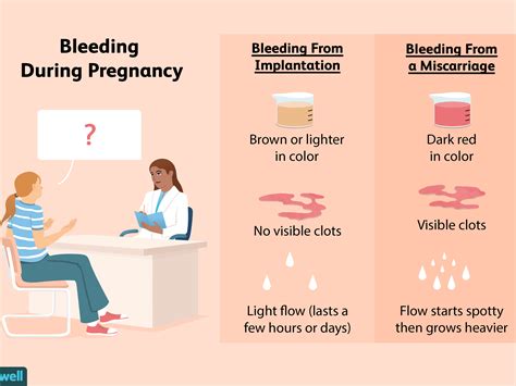 Implantation Bleeding Vs Period
