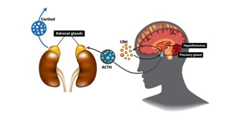 What Is Adrenal Fatigue And The Role Of Cortisol Perpetual Wellbeing