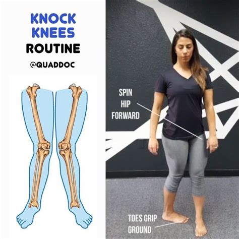 Knock Knees Routine For Tonight I Put Together A Little Something To