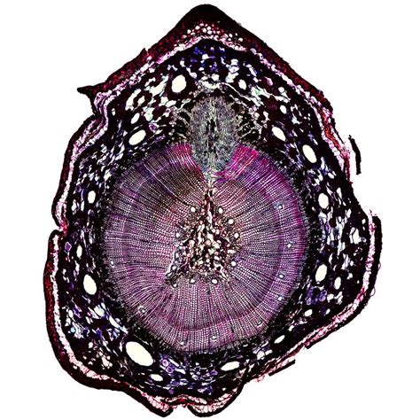 Important features in the bone cross section such as harvesian canals, osteons, osteon fragments, lamellar bone, bony trabeculae, myxoid matrix and artifact for. Pine Stem Cross Section Under Microscope | Microscopic ...