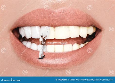 Laughing Woman Mouth With Great Teeth Over White Background Whitening