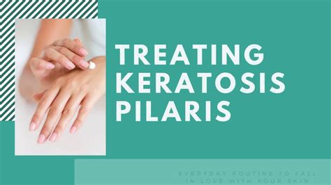 How To Get Rid Of Keratosis Pilaris Or Chicken Skin At Home 2 Easy