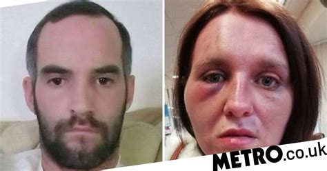 Brave Domestic Violence Victim Speaks Out Over Moment Her Ex Put A