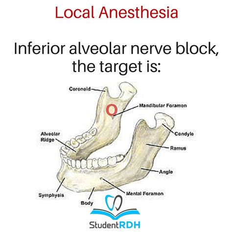 Inferior Alveolar Nerve Block Landmarks