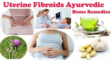 uterine fibroids best ayurvedic home remedies for treatment of fibroids youtube