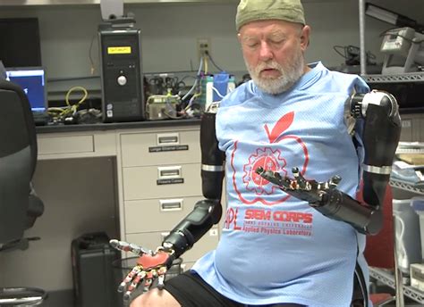 World First Man Controls Two Prosthetic Arms With His Mind Robot Arm
