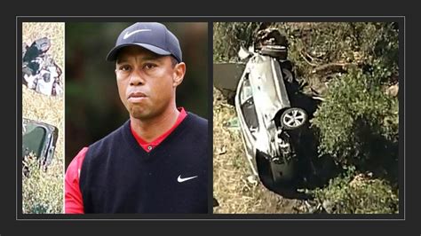 Tiger Woods Crashes In His Suv And Is In Surgery After Suffering Leg