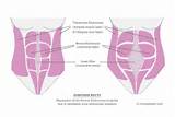 Pictures of Rectus Abdominis Muscle Exercises