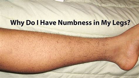Why Do I Have Numbness In My Legs Youtube