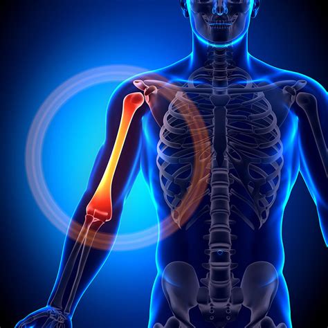 Upper Arm Muscles Pain