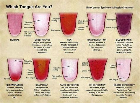 Check Out Your Tounge Tongue Health Medical Facts Health Guide