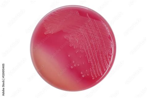 Li Escherichia Coli Bacterial Colonies On Macconkey Agar P Stock