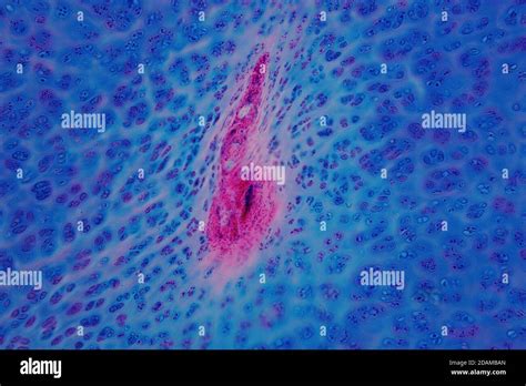 Human Hyaline Cartilage Light Micrograph Stock Photo Alamy