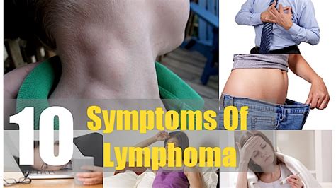 Top 10 Symptoms Of Lymphoma Ignored By Men And Women Swollen Lymph