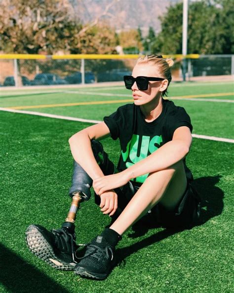 Model Who Lost Her Leg To Toxic Shock Syndrome From Her Tampon Reveals