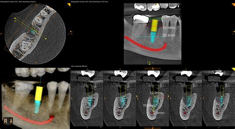 3d Cone Beam Computed Tomography Cbct Orbit Imaging Centres