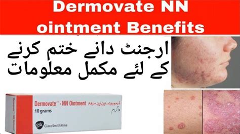 Dermovate Nn Ointmenthow To Use Dermovate For Skin Fungal Infections