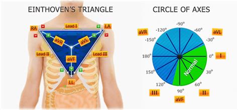 Ecg Einthovens Triangle And Cardiac Axis Aliem