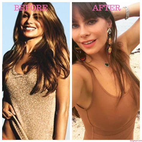 Brandi Passante Plastic Surgery Photos Before And After ⋆ Surgery4
