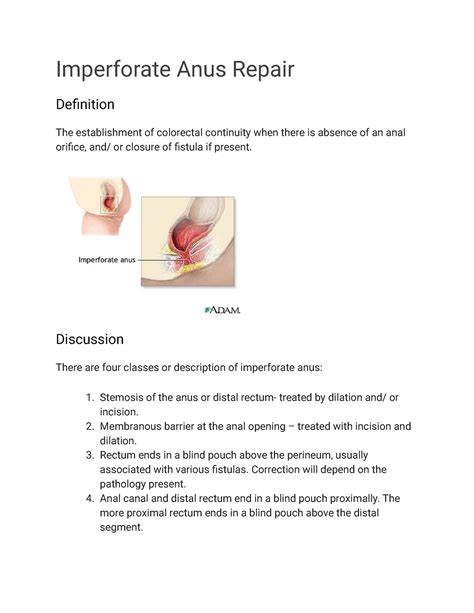 Imperforate Anus Repair Imperforate Anus Repair Definition The