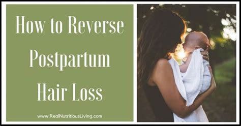 How To Reverse Postpartum Hair Loss Real Nutritious Living