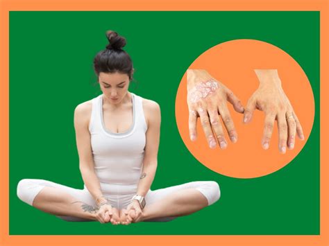 Yoga For Psoriasis Practice Yoga Zero To Hero For 0 Psoriasis
