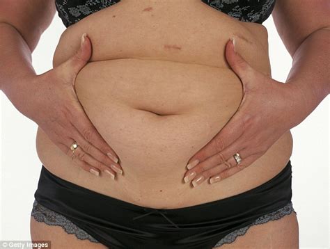 How To Lose 7 Stone But Avoid Getting Saggy Skin Daily Mail Online