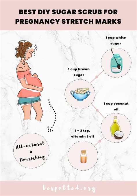 Pregnancy Stretch Marks What They Are And How To Prevent Them