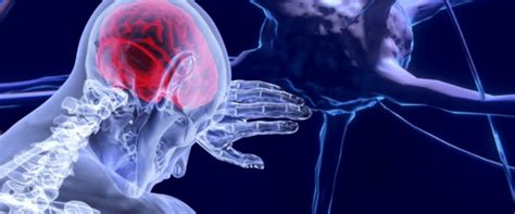 Daño Cerebral 5 Síntomas No Tan Evidentes De La Lesión Dacer Centro De