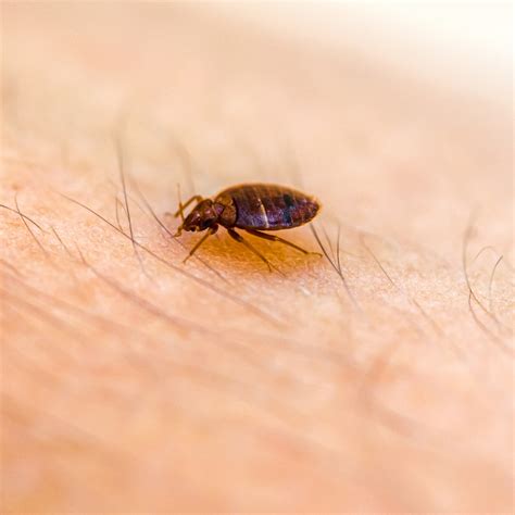 How To Remove Bedbugs