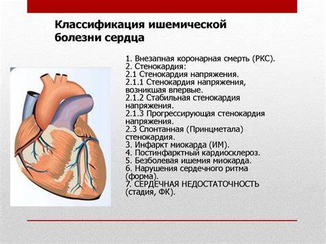 Понятие об ишемической болезни сердца ибс - фото презентация Картинка - Понятие об ишемической болезни сердца ибс - фото презентация