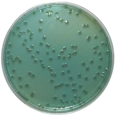 Intended use salmonella shigella agar is used for the isolation of salmonella spp. PP1520 - Hektoen Enteric Agar - E & O Laboratories Ltd