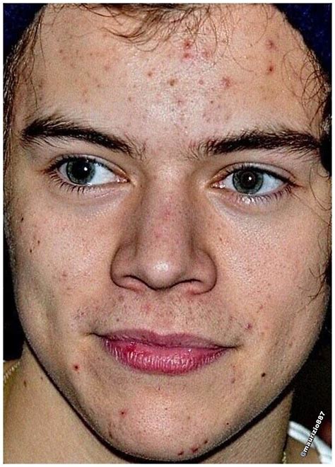 Omg I Still Liked Him Before Acne Repin If U Still Liked Him Harry Styles Eyes Harry
