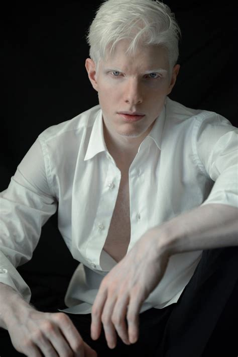 Bera Ivanishvili Inspiration For Valya Albino Model Albino Men