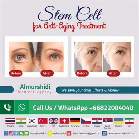 Best Anti Aging Stem Cell Therapy Package Price Almurshidi Medical