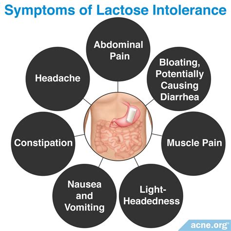 Does Lactose Intolerance Relate To Acne Acne Org