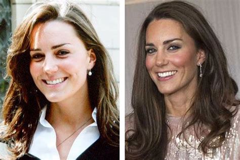 Kate Middleton Before And After Tan Hair Length Moda Kate Middleton