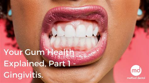 Your Gum Health Explained Part 1 Method Dental