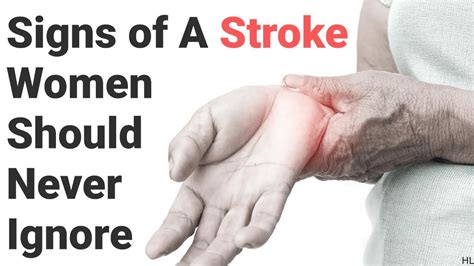Signs Of A Stroke Women Should Never Ignore Youtube