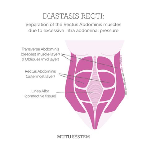 How To Check For Diastasis Recti Postnatal Health Fitmamas