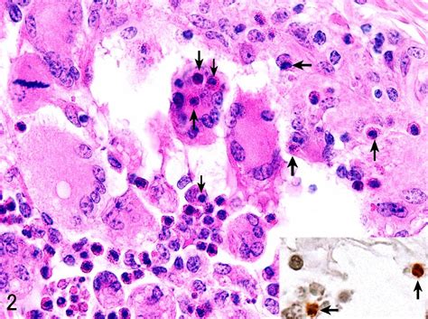 Emphysematous Eosinophilic Lymphangitis In The Bovine Rumen Atlas Of