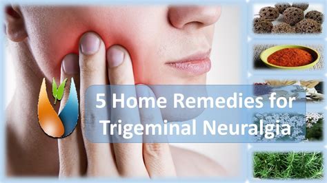 5 Home Remedies For Trigeminal Neuralgia Youtube