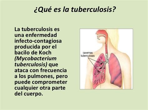 Tuberculosis E Interpretación De Bk