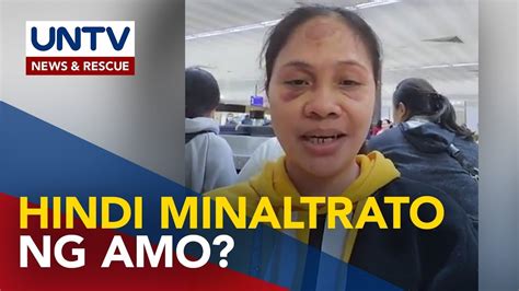 Ofw Sa Kuwait Na Nagkapasa Sa Mukha Iginiit Na Hindi Siya Sinaktan Ng Amo Kaya Umuwi Sa