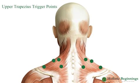 Naturally Cure Headaches With These 4 Trigger Points
