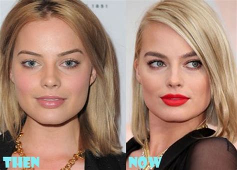 Margot robbie has undergone plastic surgery and this photo was published here on 29 july 2014 in the category plastic surgery. Margot Robbie Plastic Surgery Margot Robbie Plastic ...