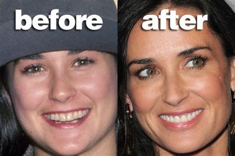 1000+ images about Celebrity Before and After Photos on Pinterest