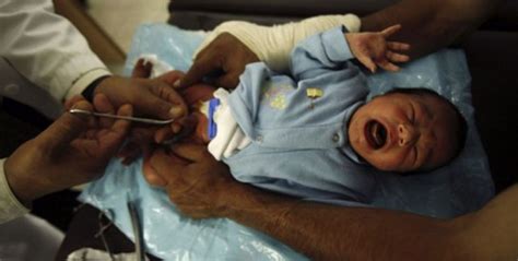 La circoncision tout savoir sur la circoncision du bébé afriquefemme com