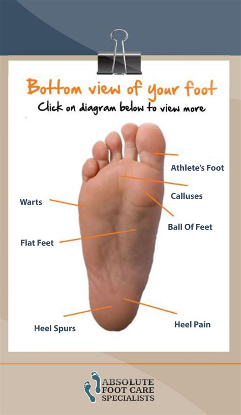 DIAGRAM Side Foot Pain Diagram MYDIAGRAM ONLINE
