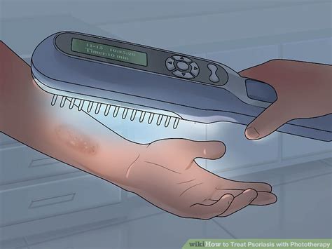 3 Ways To Treat Psoriasis With Phototherapy Wikihow